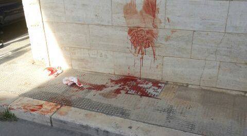 Accoltella amante della moglie, tragedia sfiorata a San Giovanni Rotondo