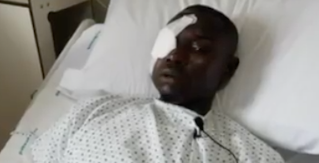 Volto fratturato e perdita parziale della vista, sotto i ferri a Casa Sollievo giovane migrante preso a sassate Volto fratturato e perdita parziale della vista, sotto i ferri a Casa Sollievo giovane migrante preso a sassate